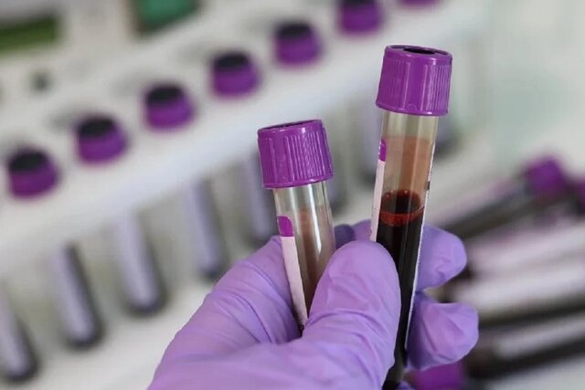 پیشبینی زوال عقل از طریق آزمایش خون پیشبینی زوال عقل از طریق آزمایش خون
